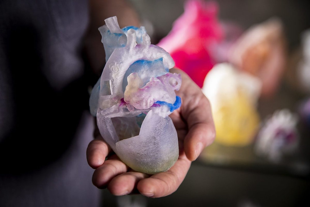 3D printing technology at Duke University helping Doctors.