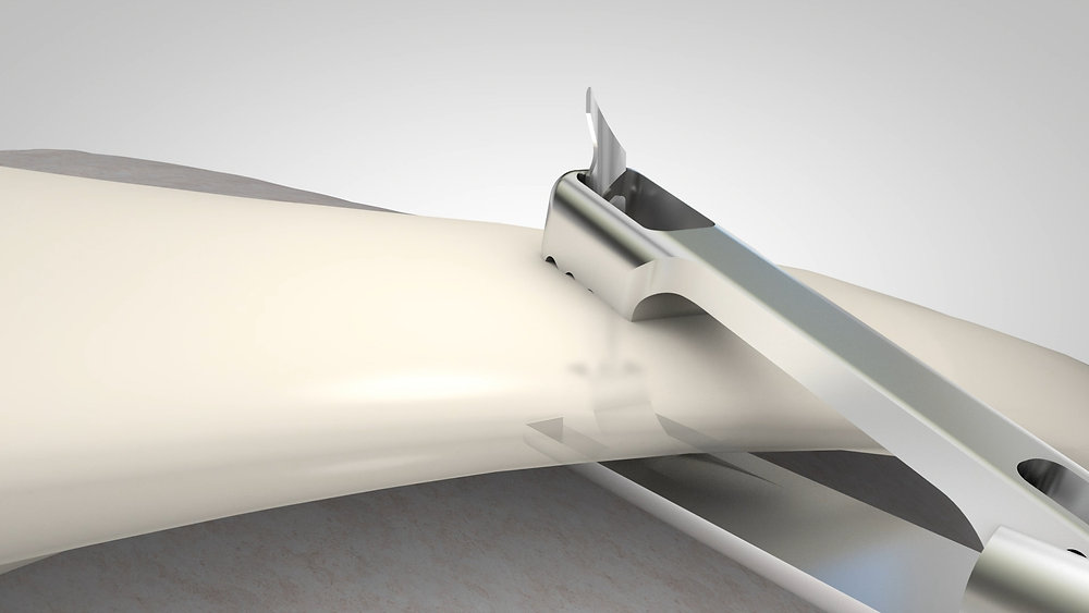 RetrieV joins Intermed Labs – WBOY